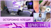 Осторожно: клещи! Программа «Здравствуйте» - 13/04/25