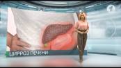 Несбалансированный рацион и его последствия / Здравствуйте